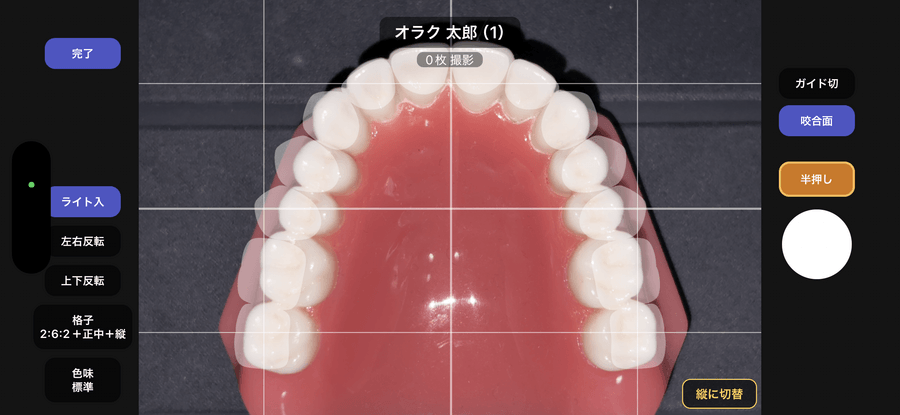 Oraku 口腔内カメラ画面 ホワイトバランス自動補正とガイド表示